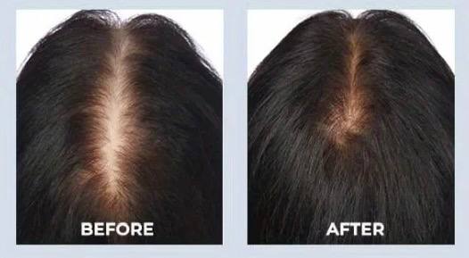 nileora GrowLux Laser Cap