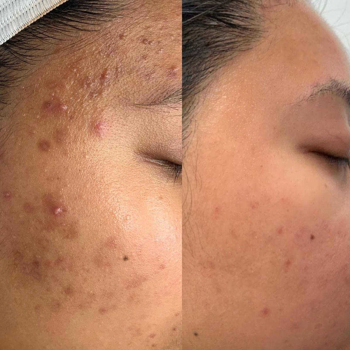 NILEORA Lumina Boost Pro