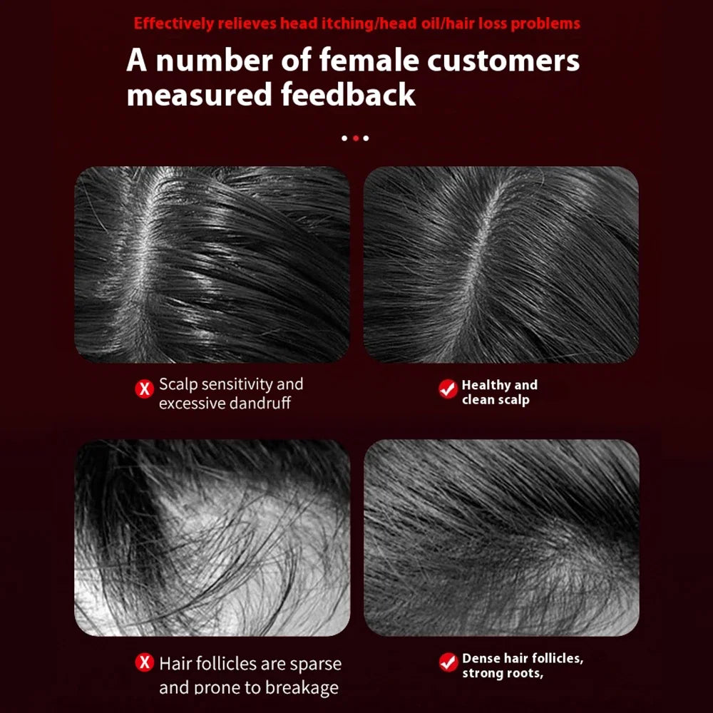 Nileora Z3 Scalp Massager