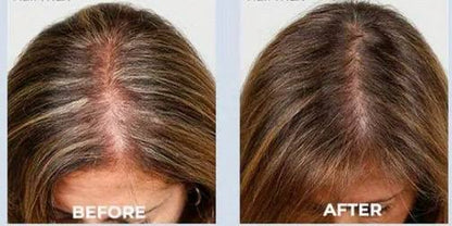 nileora GrowLux Laser Cap