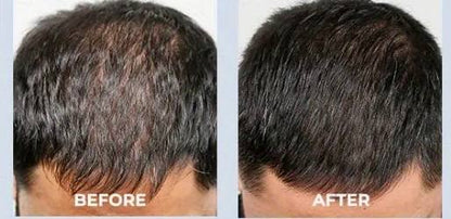 nileora GrowLux Laser Cap