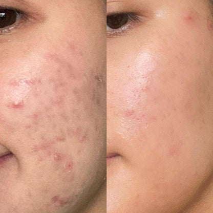 NILEORA Lumina Boost Pro