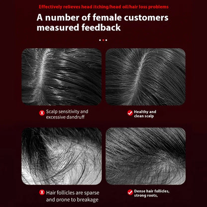 Nileora Z3 Scalp Massager